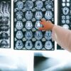 脳のfMRI画像から見えてきた、超越瞑想の実践による心が脳に与える影響